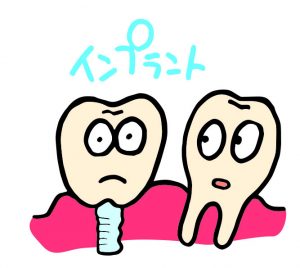 インプラント
