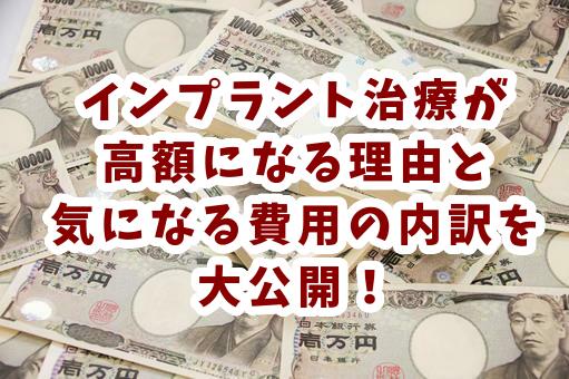 インプラントはなぜ高い?気になる費用の内訳を大公開!